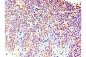 Immunohistochemistry of paraffin-embedded human tonsil tissue using ABIN7159621 at dilution of 1:100 (MECP2 anticorps  (AA 1-280))