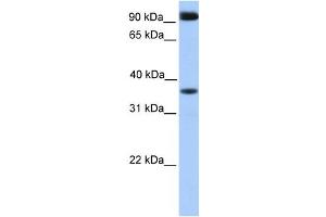 Western Blotting (WB) image for anti-DCN1, Defective in Cullin Neddylation 1, Domain Containing 4 (DCUN1D4) antibody (ABIN2459767) (DCUN1D4 anticorps)