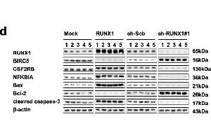 Ectopic expression of RUNX1 suppresses NB cell growth, metastasis, and angiogenesis and promotes apoptosis in vivo.