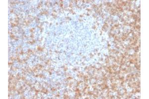 ABIN6383881 to CD5 was successfully used to stain T cells in human tonsil sections. (CD5 anticorps  (Extracellular Domain))