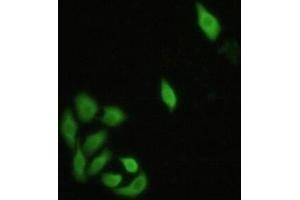 Detection of IRF3 in Hela cells using Polyclonal Antibody to Interferon Regulatory Factor 3 (IRF3) (IRF3 anticorps  (AA 1-360))