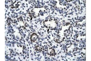 Image no. 1 for anti-RNA Binding Motif Protein 10 (RBM10) (AA 39-88) antibody (ABIN202954)