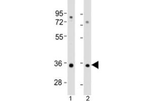 Western blot testing of human 1) A549 and 2) HT-1080 cell lysate with RSPO3 antibody at 1:2000.