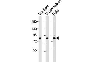 All lanes : Anti-Suz12 Antibody (Center) at 1:2000 dilution Lane 1: mouse spleen lysates Lane 2: mouse cerebellum lysates Lane 3: Hela whole cell lysates Lysates/proteins at 20 μg per lane. (SUZ12 anticorps  (AA 381-395))