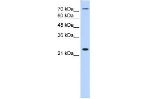 CLDN2 antibody (20R-1258) used at 0. (Claudin 2 anticorps  (N-Term))