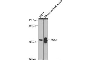 Western blot analysis of extracts of various cell lines using MYL2 Polyclonal Antibody at dilution of 1:3000.