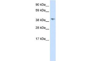 WB Suggested Anti-MSL3L1 Antibody Titration:  0. (MSL3 anticorps  (C-Term))