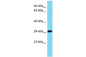 Host: Rabbit Target Name: CDRT15L2 Sample Type: Jurkat Whole Cell lysates Antibody Dilution: 1. (CDRT15L2 anticorps  (N-Term))