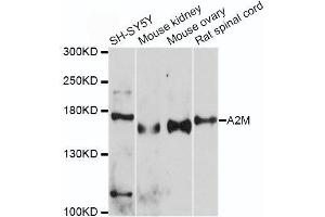 Western blot analysis of extracts of various cell lines, using A2M antibody.