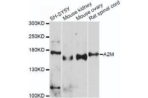Western blot analysis of extracts of various cell lines, using A2M antibody. (alpha 2 Macroglobulin anticorps  (AA 1155-1474))
