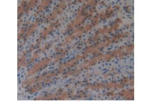 Detection of ARG in Rat Stomach Tissue using Monoclonal Antibody to Arginase (ARG) (ARG anticorps  (AA 1-323))
