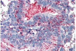 Anti-CDCP1 antibody  ABIN960753 IHC staining of human uterus. (CDCP1 anticorps  (Extracellular Domain))