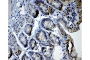 IHC analysis of CRY1 using anti-CRY1 antibody (ABIN3042761). (CRY1 anticorps  (N-Term))
