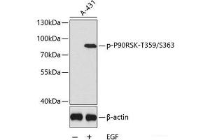Western blot analysis of extracts of A431 cells using Phospho-P90RSK(T359/S363) Polyclonal Antibody.