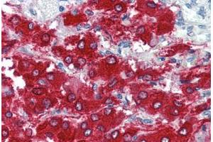 Human Adrenal (formalin-fixed, paraffin-embedded) stained with TH antibody ABIN337188 at 5 ug/ml followed by biotinylated goat anti-rabbit IgG secondary antibody ABIN481713, alkaline phosphatase-streptavidin and chromogen. (Tyrosine Hydroxylase anticorps  (pSer40))
