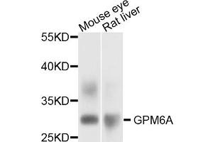 Western blot analysis of extract of mouse eye and rat liver cells, using GPM6A antibody. (GPM6A anticorps)