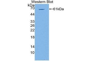 Western Blotting (WB) image for anti-Solute Carrier Family 22 (Organic Cation Transporter), Member 1 (SLC22A1) (AA 128-391) antibody (ABIN2117055)