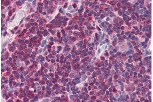 Human Thymus (formalin-fixed, paraffin-embedded) stained with MIF antibody ABIN337308 at 2. (MIF anticorps  (AA 103-115))