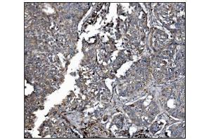 IHC analysis of LRP1B using anti-LRP1B antibody (ABIN7601521). (LRP1B anticorps  (AA 3704-4547))