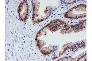 Image no. 1 for anti-Mannose Phosphate Isomerase (MPI) antibody (ABIN1499545) (MPI anticorps)