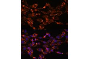Immunofluorescence analysis of NIH/3T3 cells using Monoamine Oxidase A (Monoamine Oxidase A (MAOA)) antibody (ABIN3021915, ABIN3021916, ABIN3021917 and ABIN6217576) at dilution of 1:100. (Monoamine Oxidase A anticorps  (AA 1-260))