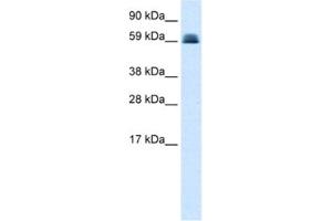 Western Blotting (WB) image for anti-Zinc Finger and BTB Domain Containing 45 (ZBTB45) antibody (ABIN2460150) (ZBTB45 anticorps)