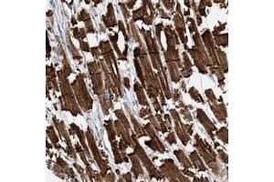 Immunohistochemical staining of human heart muscle with FAM26E polyclonal antibody  shows strong cytoplasmic and membranous positivity in myocytes at 1:500-1:1000 dilution. (FAM26E anticorps)