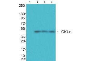 Western blot analysis of extracts from HuvEc cells (Lane 2), JK cells (Lane 3) and cos-7 cells (Lane 4), using CKI-ε antiobdy antiobdy. (CK1 epsilon anticorps)