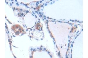 Detection of GbL in Human Thyroid Tissue using Polyclonal Antibody to G Protein Beta Subunit Like Protein (GbL)
