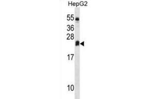 Western Blotting (WB) image for anti-Dehydrogenase/reductase (SDR Family) Member 4 Like 2 (DHRS4L2) antibody (ABIN3000211) (DHRS4L2 anticorps)