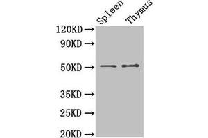Western Blot Positive WB detected in: Mouse spleen tissue, Mouse thymus tissue All lanes: TUBB3 antibody at 1.
