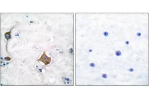 Immunohistochemistry analysis of paraffin-embedded human brain tissue, using Synaptophysin Antibody. (Synaptophysin anticorps  (AA 101-150))