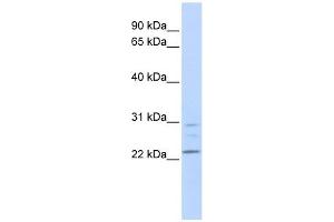 LYPLA1 antibody used at 1 ug/ml to detect target protein.