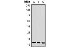 Western blot analysis of CKLF1 expression in Jurkat (A), K562 (B), NIH3T3 (C) whole cell lysates.