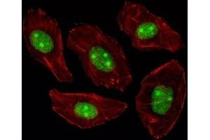 Fluorescent image of A549 cells stained with NPM1 antibody.