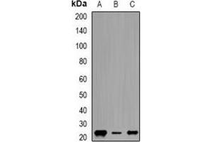 Western blot analysis of Geminin expression in HepG2 (A), MCF7 (B), K562 (C) whole cell lysates.