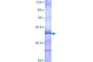 Image no. 1 for Sema Domain, Immunoglobulin Domain (Ig), Transmembrane Domain (TM) and Short Cytoplasmic Domain, (Semaphorin) 4C (SEMA4C) (AA 536-635) protein (GST tag) (ABIN1319476)