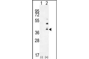 Western blot analysis of TNFSF15 (arrow) using rabbit polyclonal TNFSF15 Antibody (Center) (ABIN655822 and ABIN2845246). (TNFSF15 anticorps  (AA 148-175))