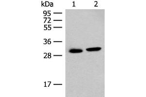 Western blot analysis of Mouse kidney tissue and Human kidney tissue lysates using GLYAT Polyclonal Antibody at dilution of 1:300