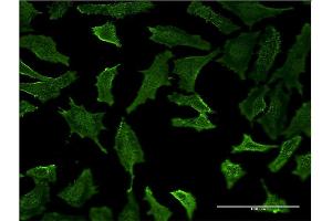Immunofluorescence of monoclonal antibody to HLA-DMB on HeLa cell.