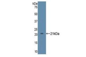 WB of Protein Standard: different control antibodies against Highly purified E. (TNF alpha Kit ELISA)
