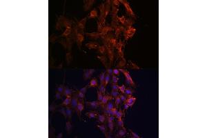 Immunofluorescence analysis of C6 cells using KIF5B Rabbit pAb (ABIN7268136) at dilution of 1:100 (40x lens).