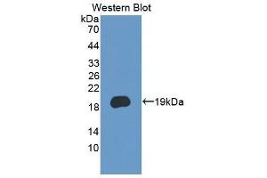 Figure. (PCDH20 anticorps  (AA 64-209))