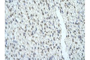 Rabbit Anti-SFRS2B antibody   Paraffin Embedded Tissue: Human Heart cell Cellular Data: cardiac cell of renal tubule Antibody Concentration: 4. (SFRS2B anticorps  (Middle Region))