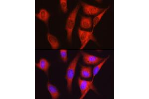 Immunofluorescence analysis of U2OS cells using S6 Ribosomal Protein (RPS6) Rabbit pAb (ABIN6133901, ABIN6147227, ABIN6147228 and ABIN6221687) at dilution of 1:100 (40x lens).