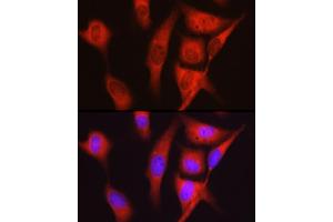 Immunofluorescence analysis of U2OS cells using S6 Ribosomal Protein (RPS6) Rabbit pAb (ABIN6133901, ABIN6147227, ABIN6147228 and ABIN6221687) at dilution of 1:100 (40x lens).