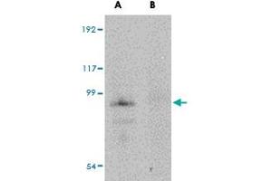 Western blot analysis of JPH4 in mouse brain tissue lysate with JPH4 polyclonal antibody  at 1 ug/mL in (A) the absence and (B) the presence of blocking peptide. (Junctophilin 4 anticorps  (Internal Region))