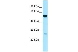 Host:  Rabbit  Target Name:  GSTP1  Sample Type:  Placenta lysates  Antibody Dilution:  1. (GSTP1 anticorps  (N-Term))