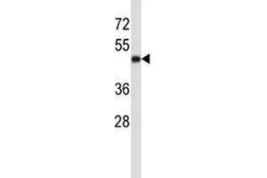 CD1a antibody western blot analysis in MDA-MB231 lysate.