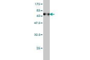 Western Blot detection against Immunogen (74. (Fatty Acid Synthase anticorps  (AA 1-439))